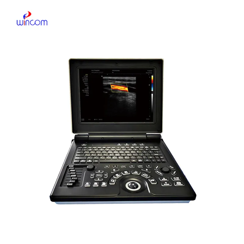 Laptop-Farbdoppler-Ultraschalldiagnosesystem USS-N20C